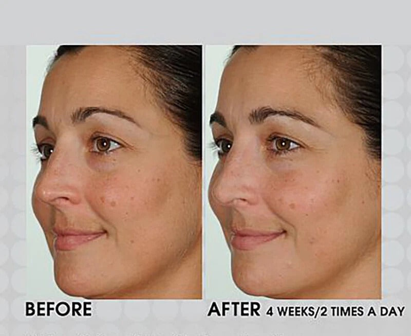 Pure Retinol Vitamin A Serum