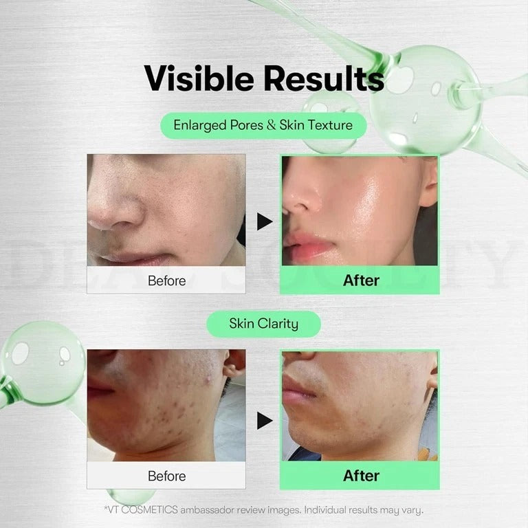 VT CICA Reedle Shot Serum
